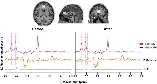 木头就能改善你的记忆力？凯发k8登录为什